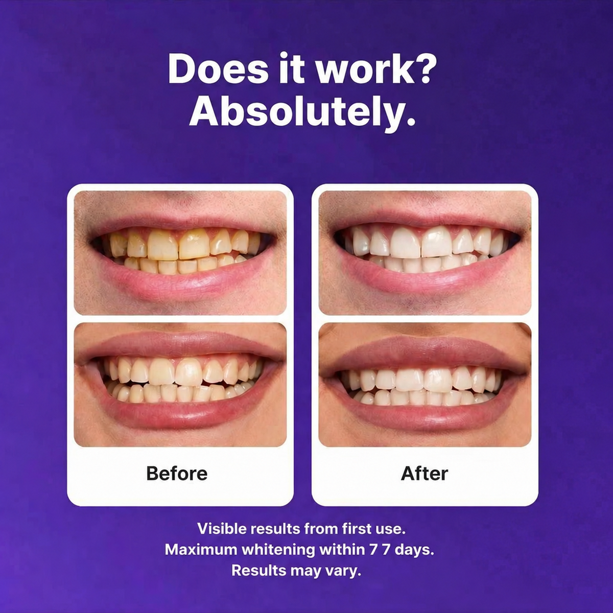 MORVAIL Purple Teeth Whitening Strips