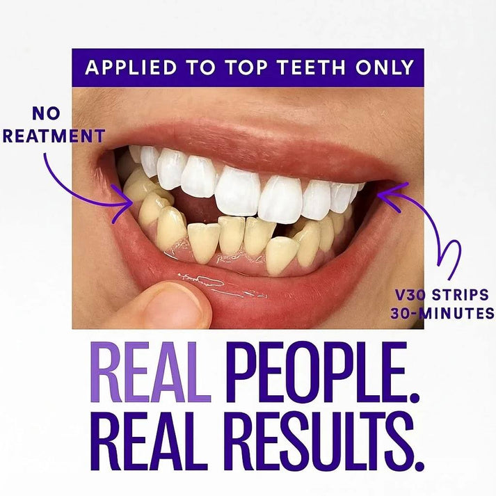 MORVAIL Purple Teeth Whitening Strips