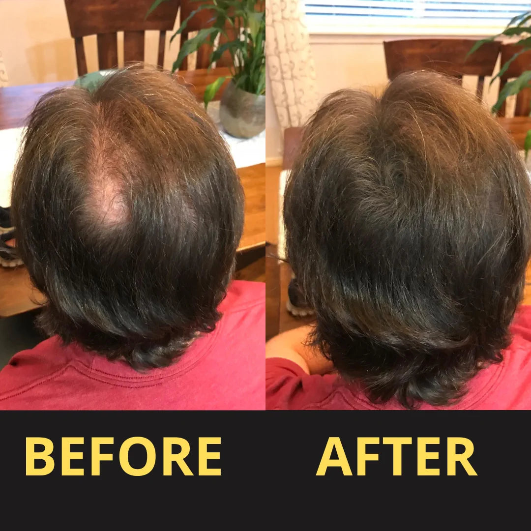Hair Concealer before and after result
