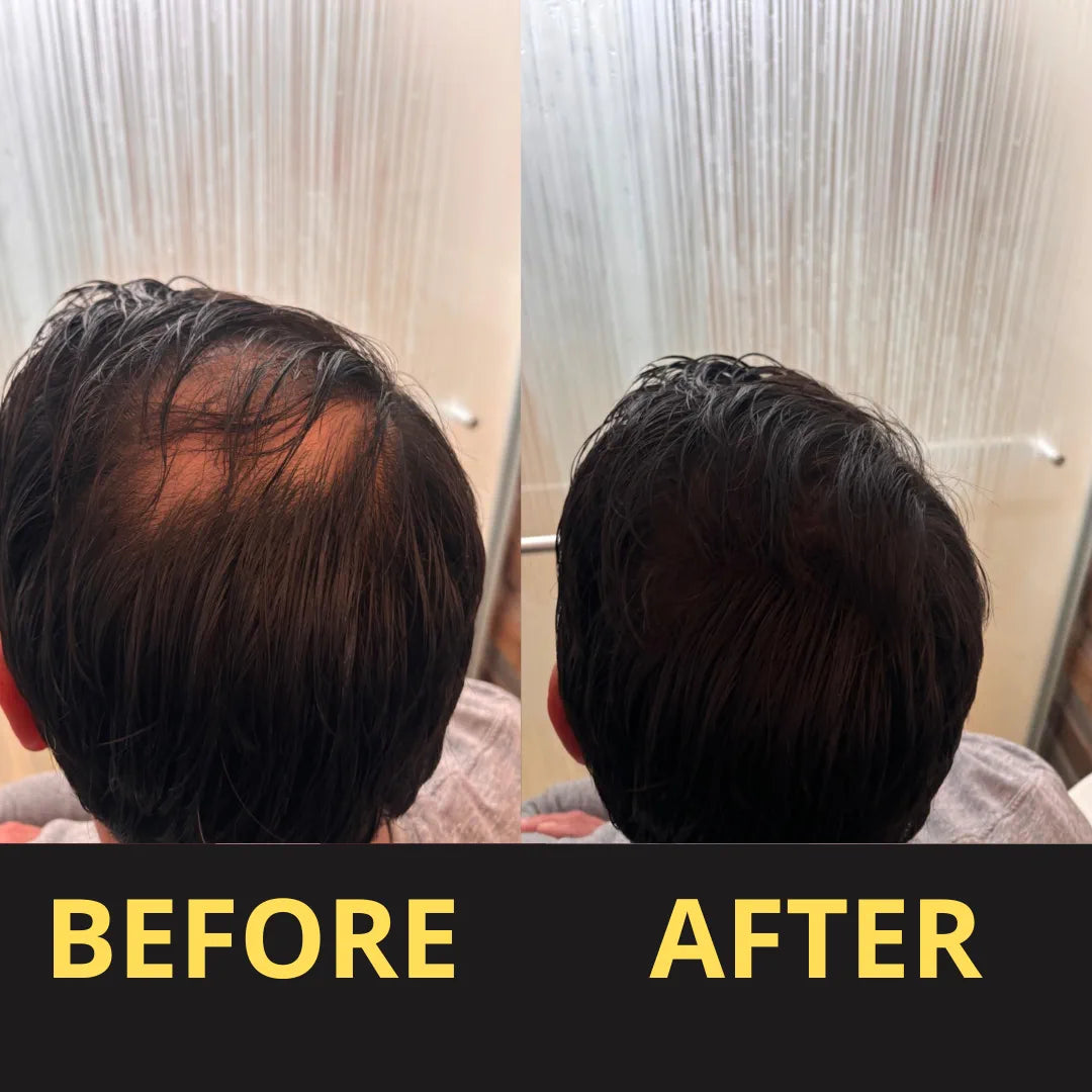 Hair Concealer before and after result
