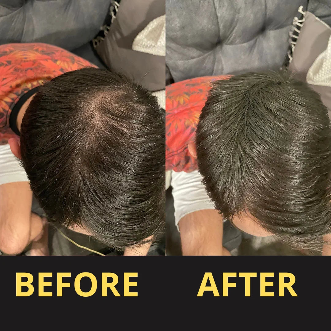 Hair Concealer before and after result