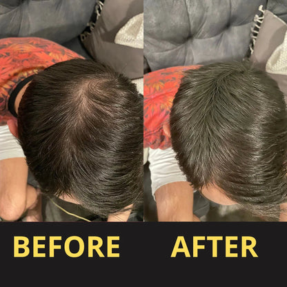 Hair Concealer before and after result