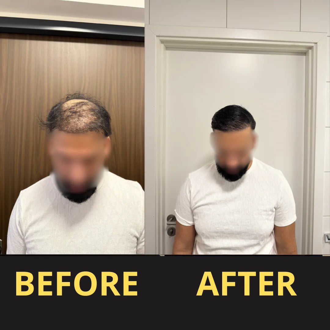 Hair Concealer before and after result