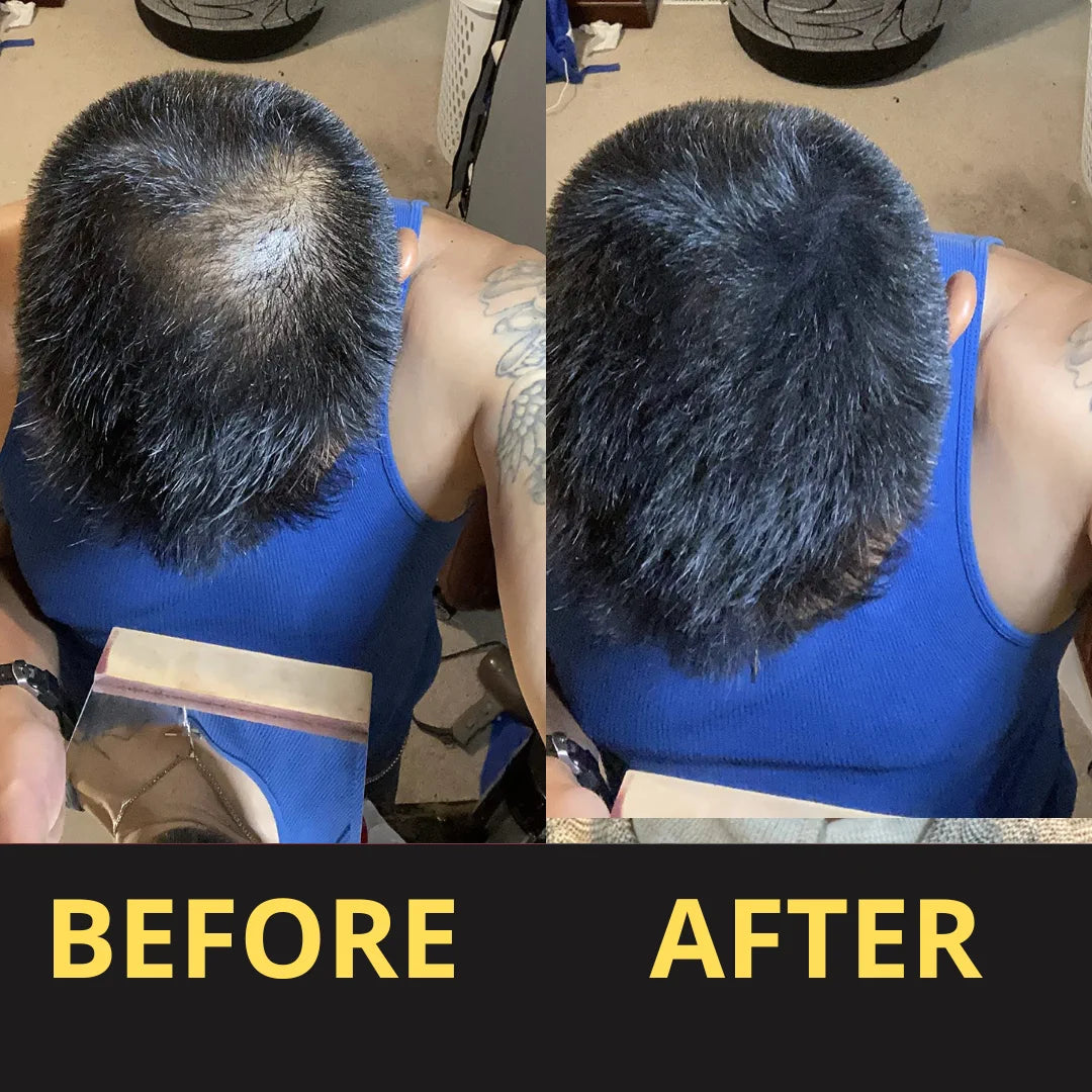 Hair Concealer before and after result