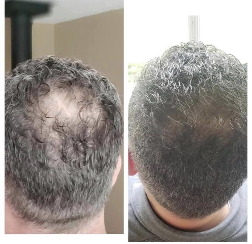Root Activator Shampoo before and after result