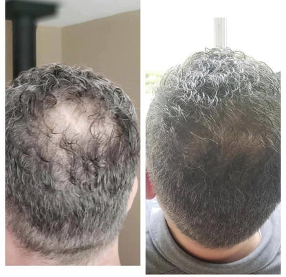 Root Activator Shampoo before and after result