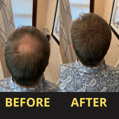 Hair Concealer before and after result