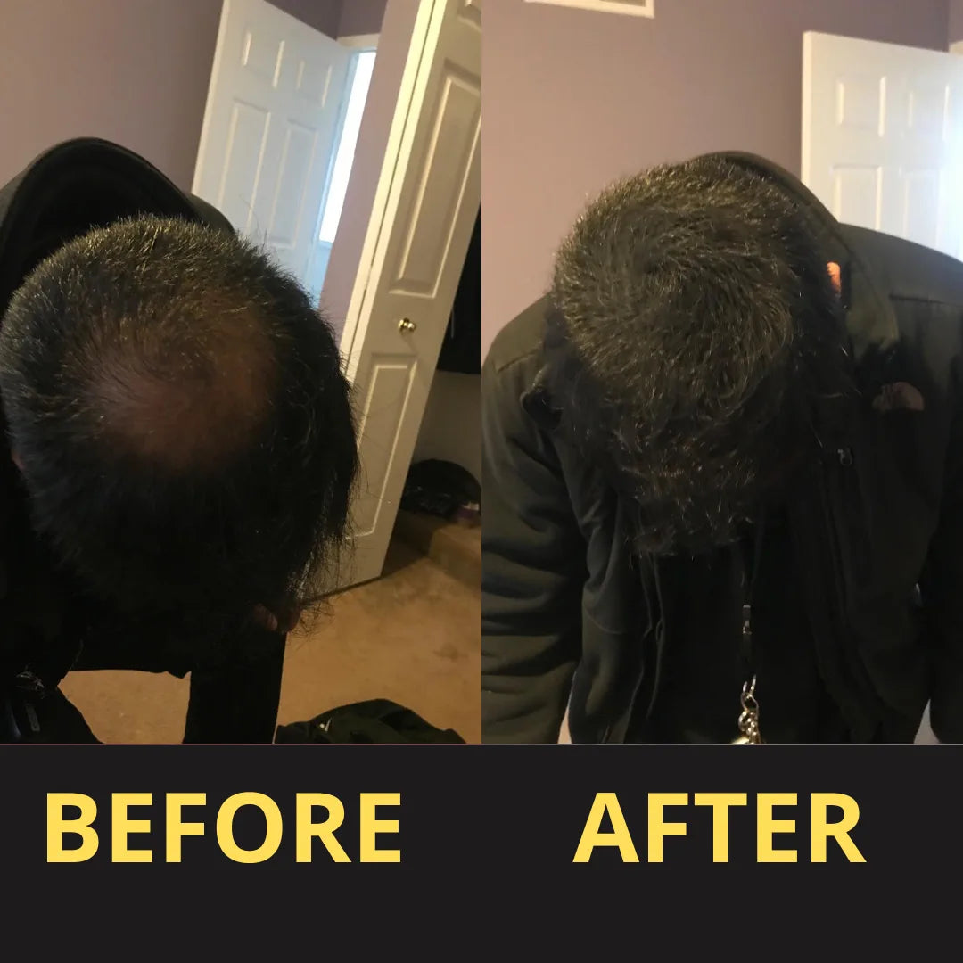 Hair Concealer before and after result