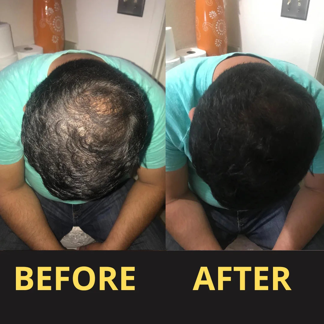 Hair Concealer before and after result