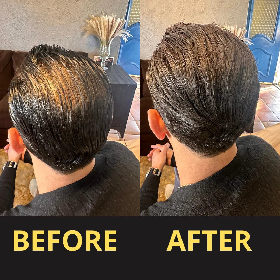 Hair Concealer before and after result