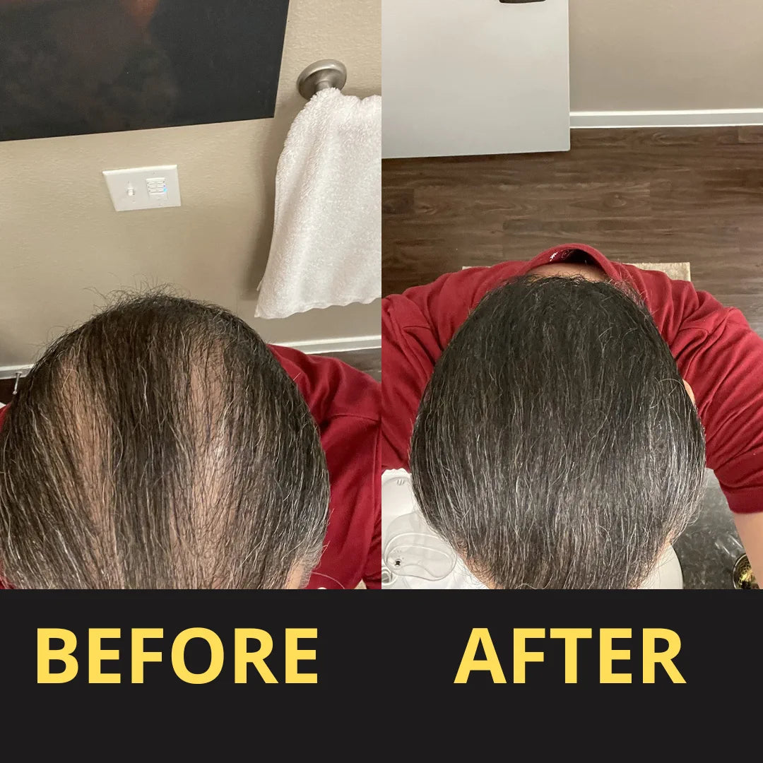 Hair Concealer before and after result