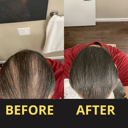Hair Concealer before and after result