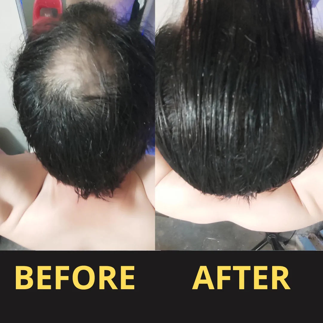 Hair Concealer before and after result
