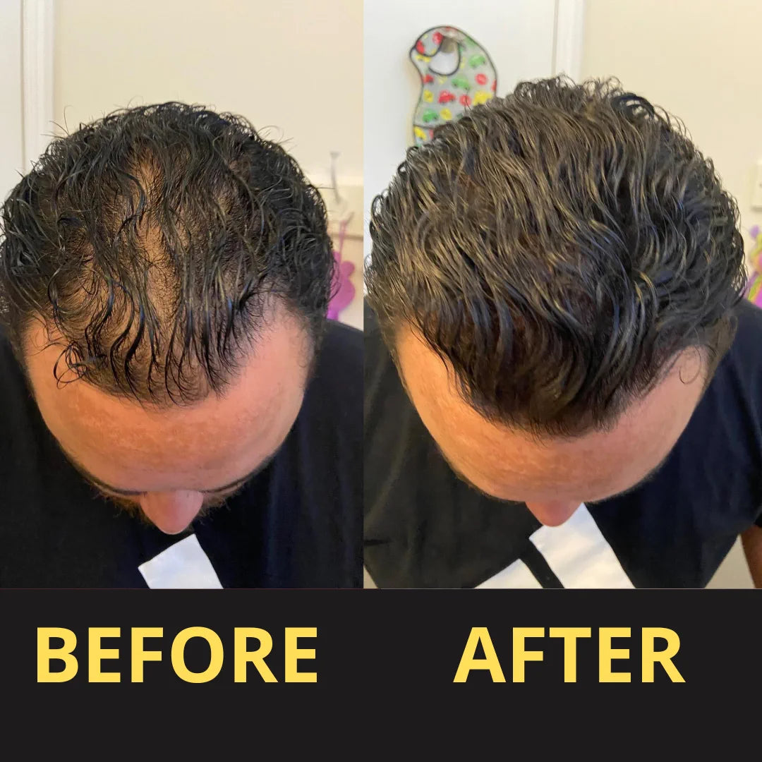 Hair Concealer before and after result
