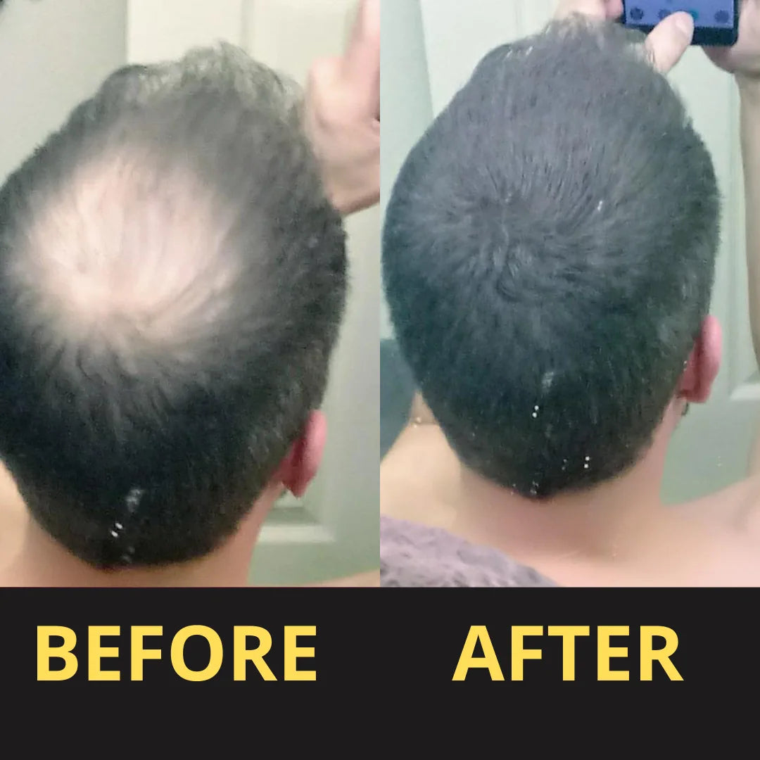Hair Concealer before and after result