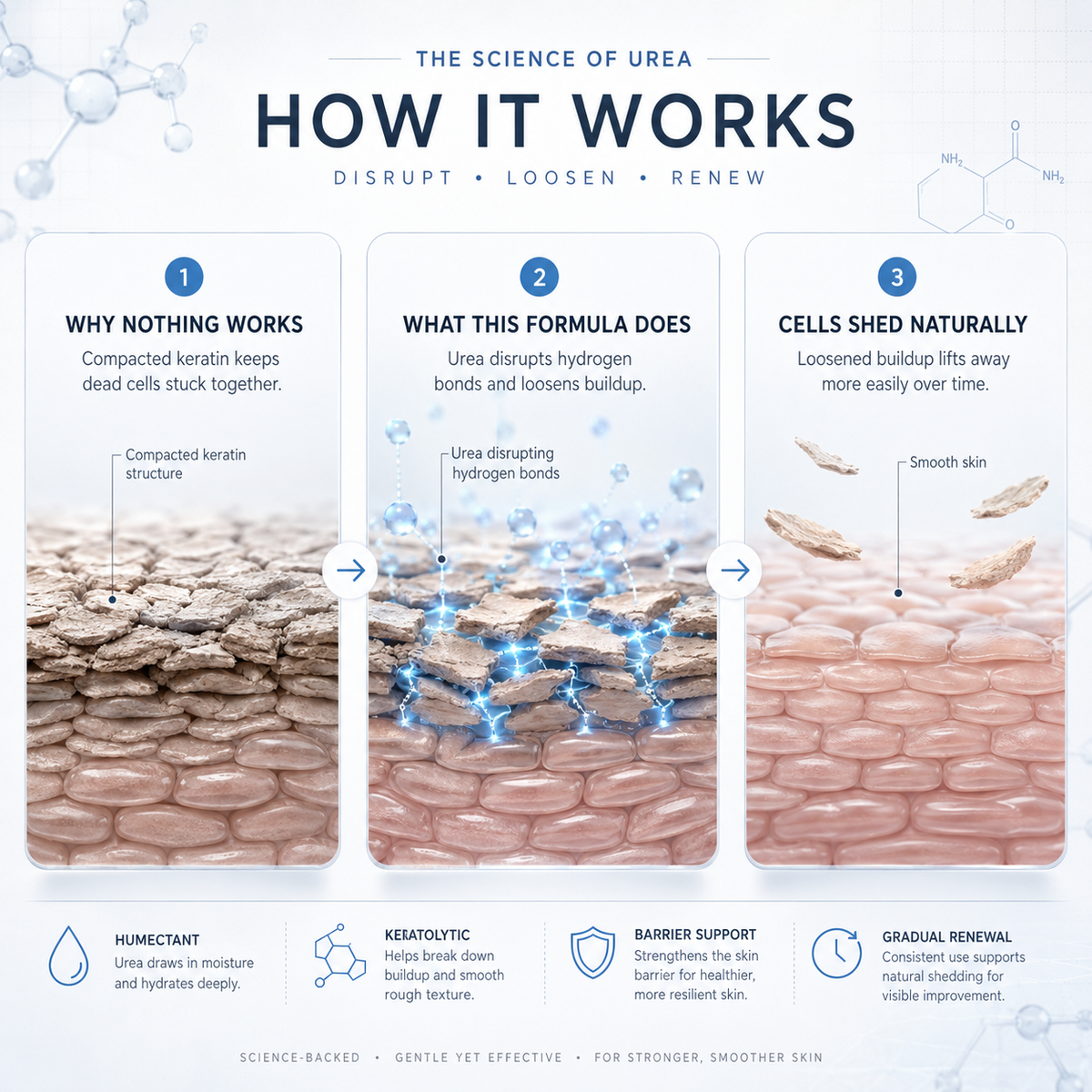 MORVAIL — How urea works