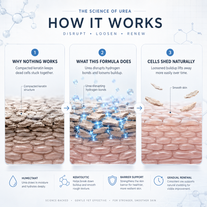 MORVAIL — How urea works
