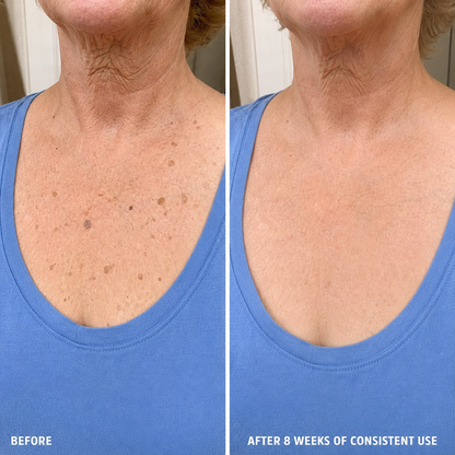 MORVAIL — Reference result photograph 3